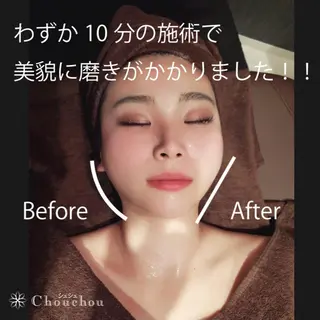 痩身・小顔・美肌専門 Chou chouのエステ・リラクイメージ