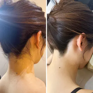 うなじ脱毛/美肌脱毛 LABELのエステ・リラクイメージ