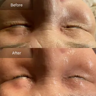 Mandarin Orange所属・毛穴から始める肌メン テマンダリンオレンジのエステ・リラクイメージ