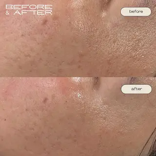 BeautySalon moze所属・moze 對島のエステ・リラクイメージ