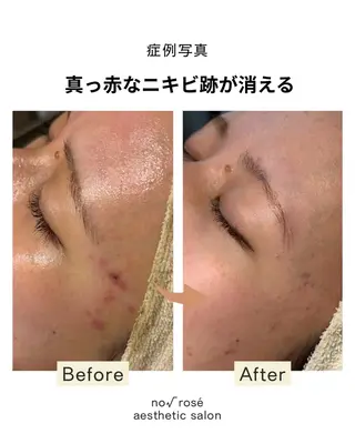 ノールート ロゼのエステ・リラクイメージ