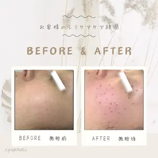 シミケア専門店 Saimervellのエステ・リラクイメージ