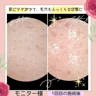 ペルラジョーネ💄 emiのエステ・リラクイメージ