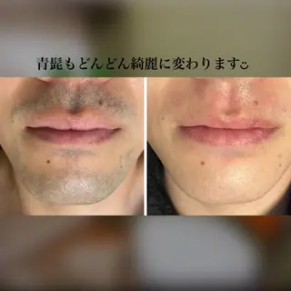 bel étéのエステ・リラクイメージ