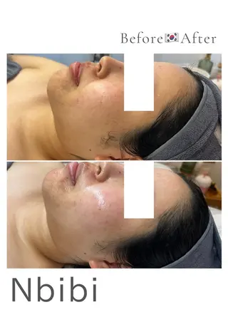 韓国🇰🇷価格 サロン_Nbibiのエステ・リラクイメージ