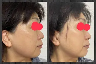 杉原 里奈のエステ・リラクイメージ