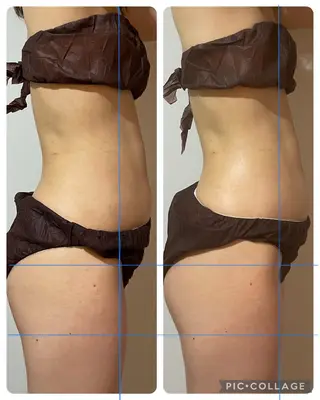 癒し腸もみサロン シャユーム　ゆきなのエステ・リラクイメージ