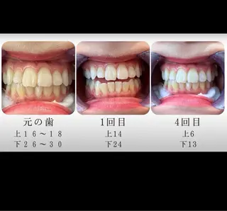 セルフホワイトニング エクシア宮崎花ヶ島店のその他イメージ