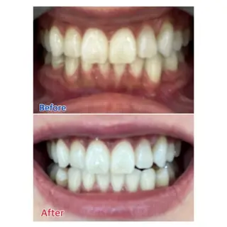 M渋谷店所属・Ｍ渋谷 ホワイトニングのその他イメージ