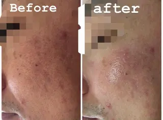 セミロング カラー パーマ ヘアアレンジ メンズ キッズ ネイル マツエク・マツパ Amaryllis 🌹のエステ・リラクイメージ