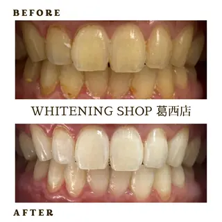 メンズ ホワイトニング ショップ葛西店のその他イメージ