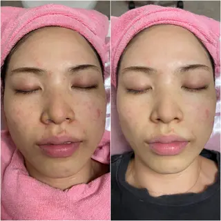 透明感の肌Lino malieのエステ・リラクイメージ