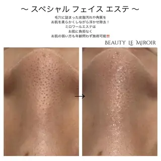 ビューティー ミロワールのエステ・リラクイメージ