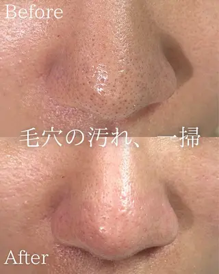 美肌脱毛&毛穴専門 Nico🐰ྀི♡のエステ・リラクイメージ