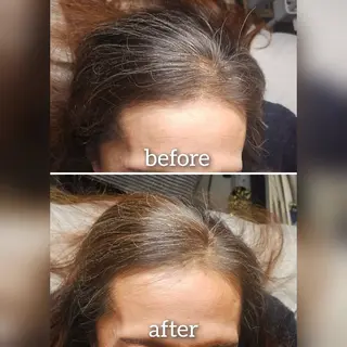 ヘアアレンジ 歯科提携セルフダック 宇都宮駒生店のエステ・リラクイメージ