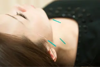 鍼灸 PALMのエステ・リラクイメージ