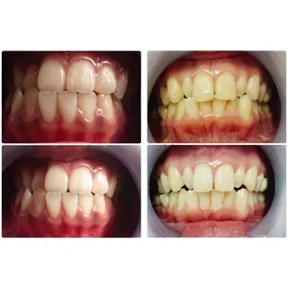 NailBeauty marcherのエステ・リラクイメージ