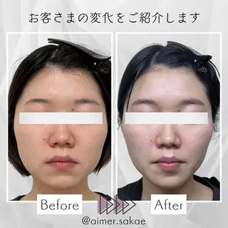 aimer 佐々木のエステ・リラクイメージ