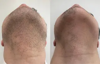 ボヌール ビューティサロンのエステ・リラクイメージ