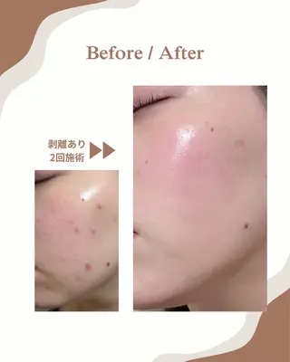 myherb所属・ニキビ肌改善サロン myherb🌿のエステ・リラクイメージ