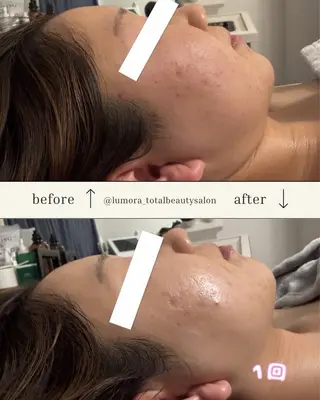 TOTAL BEAUTYSALON LUMORA所属・LUMORA🌟 トータルビューティーのエステ・リラクイメージ