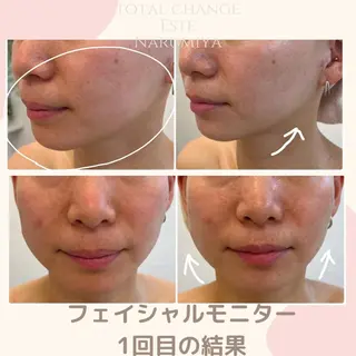 辻 佐耶のエステ・リラクイメージ