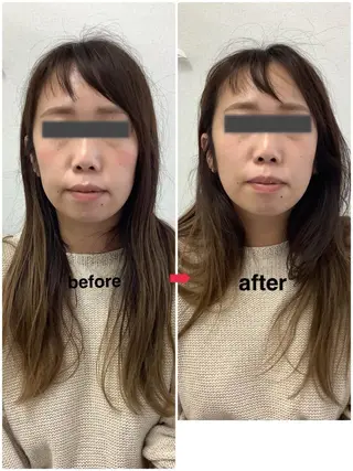 メディカルサロンドオフ所属・ハリサロンドオフ 美容鍼灸×小顔整体のエステ・リラクイメージ