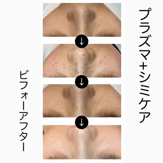 ハーブピーリング専門 muro.のエステ・リラクイメージ