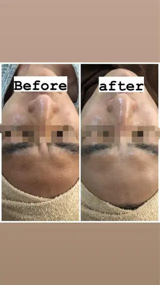 ショート カラー パーマ ヘアアレンジ メンズ キッズ ネイル マツエク・マツパ アイブロウ Amaryllis 🌹のエステ・リラクイメージ