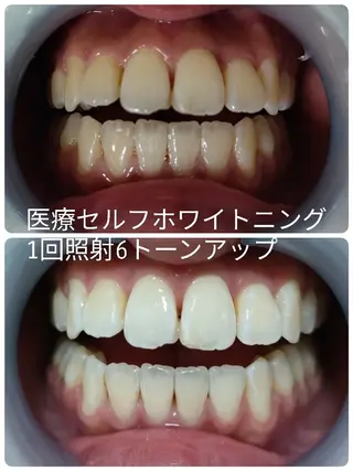 ほわいと あざぶのマツエク・マツパデザイン