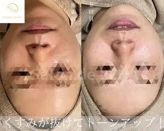 サロンドレナ名駅店所属・ハーブピーリング専門 サロンドレナ平岡のエステ・リラクイメージ