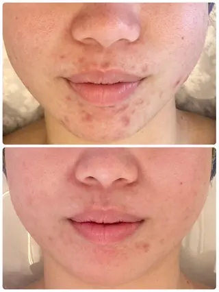 肌質改善サロン Manaririoのエステ・リラクイメージ