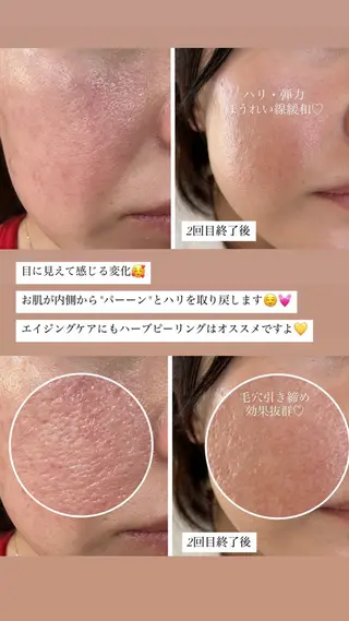 【新宿】 PulBeauteのエステ・リラクイメージ