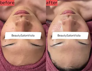 Beauty SalonViolaのエステ・リラクイメージ
