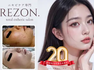 レチノール/ニキビ/ 毛穴ケア 浅川のエステ・リラクイメージ