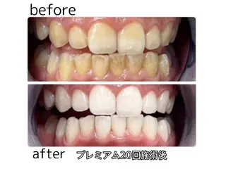 凛 リンのネイルデザイン