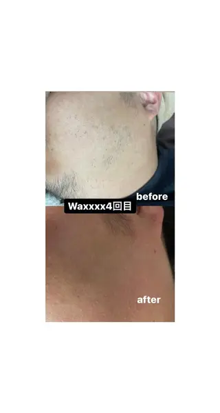 メンズ Epina 千葉店 【エピナ】のエステ・リラクイメージ