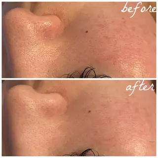 メンズ メナード岐阜市茜部 杉浦のエステ・リラクイメージ