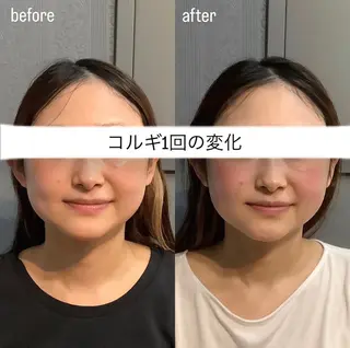 エステサロンino.colore'所属・小顔サロン ino.coloreのエステ・リラクイメージ