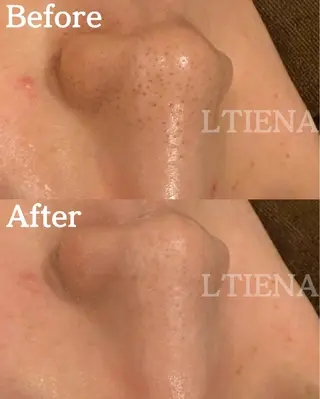 LTIENA新宿🌷 maiのエステ・リラクイメージ