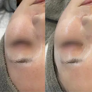 LEPUS (レプス)sasaのエステ・リラクイメージ