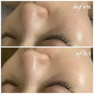 メンズ メナード岐阜茜部 杉浦のエステ・リラクイメージ