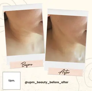 Upm.所属・成島 星哉のエステ・リラクイメージ