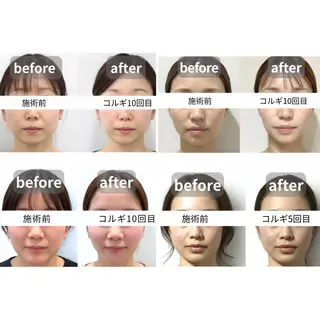 小顔コルギSalon de ETULEのエステ・リラクイメージ