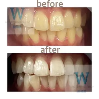 ホワイトニング ショップ船橋2号店のエステ・リラクイメージ