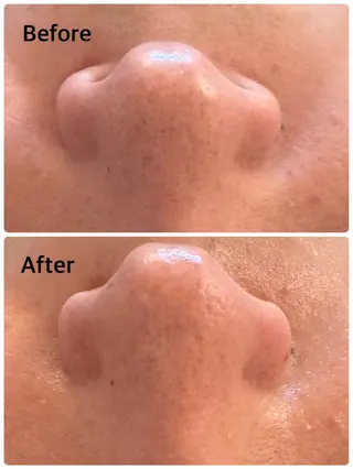 クリニカルサロン ANISHのエステ・リラクイメージ