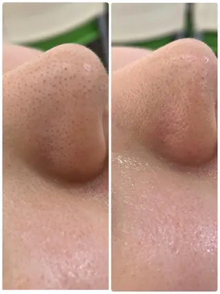 矢本 祥子のエステ・リラクイメージ