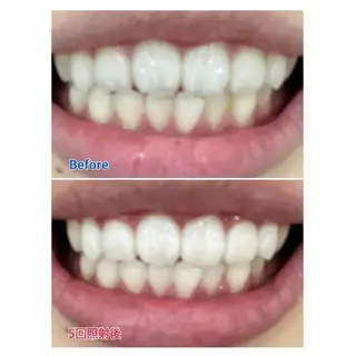 M渋谷店所属・M渋谷 ホワイトニングのエステ・リラクイメージ