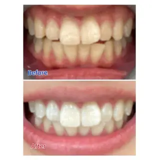 M渋谷店所属・M渋谷 ホワイトニングのエステ・リラクイメージ