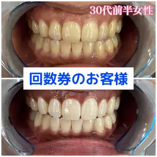 Platinum Beauty 四条烏丸店所属・吉田亮利 ホワイトニング専門店のその他イメージ